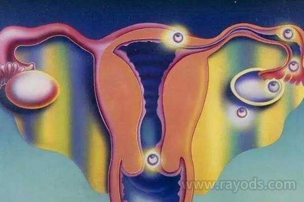 武清哪里有靠谱代孕机构,试管婴儿女人取卵痛吗-患有子宫内膜炎做试管要注意