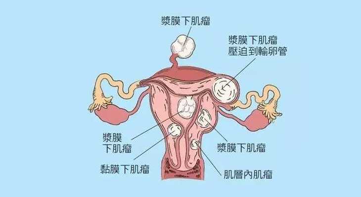 虹口代怀孕的权威机构,做试管婴儿取卵泡是怎么取，要做手术吗_唐山哪个医院
