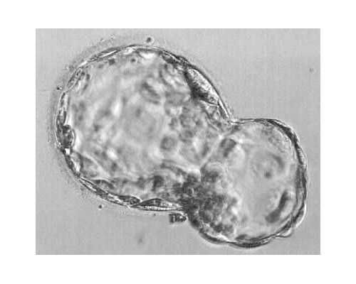 代怀代生靠谱吗_代怀宝宝的血型,上海试管供卵代怀助孕机构最新排名,附试管最