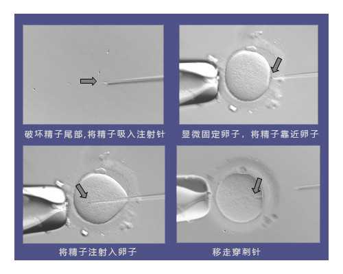 (a)代孕网怎么样,沈阳供卵15万包生男孩不可信，2022年辽宁供卵试管助孕费用明