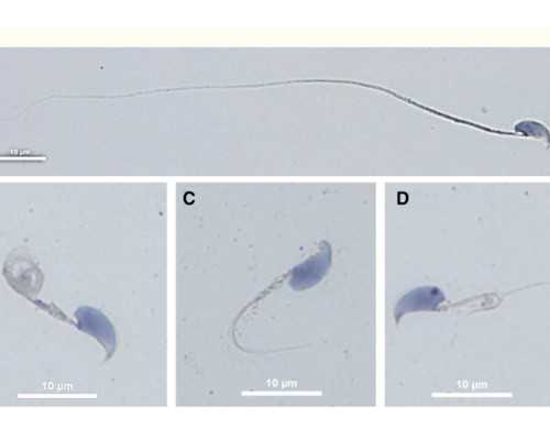 每42个新生儿就有1对双胞胎,新生儿