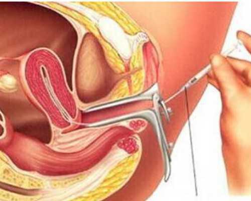 (a)医院代孕多少钱,石家庄助孕包成功价格？2023年石家庄做试管婴儿成功率医院