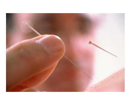 (a)代孕,石家庄供卵试管医院哪家好附供卵试管婴儿费用