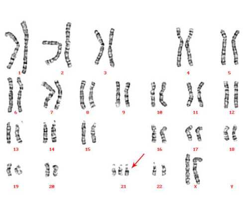 (a)代孕中心在哪里,石家庄没有子宫有卵巢可以做试管婴儿吗_试管助孕机构