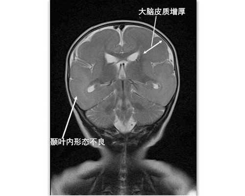 (a)哪里做代孕较好,2022石家庄试管婴儿助孕费用明细一览表-附成功率参考指南